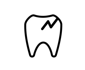 歯の怪我の治療法：歯のヒビ│大府市の歯医者・大府東歯科